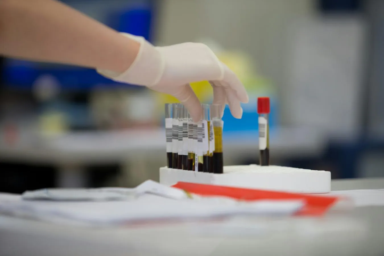 photo of lab test tubes filled with blood